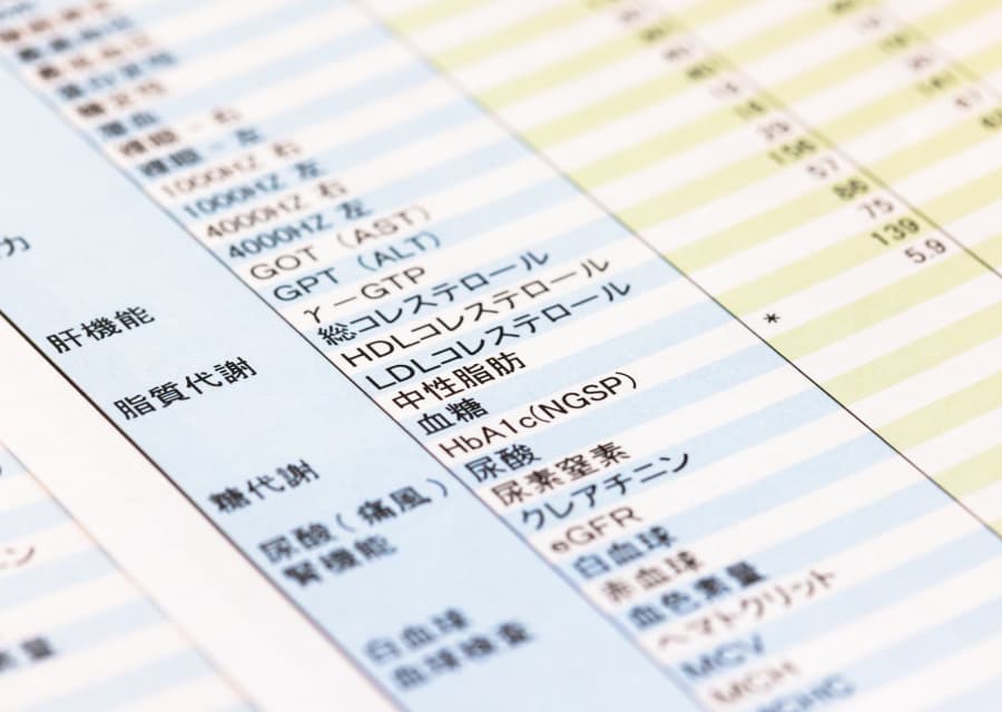 検査